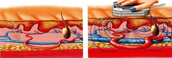 se le tue gambe diventano insensibili