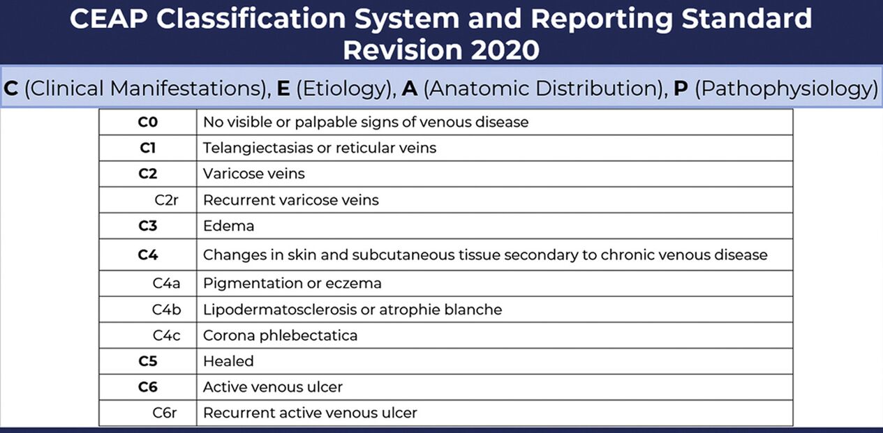 Fasi delle vene varicose secondo la classificazione CEAP con modifiche dal 2020